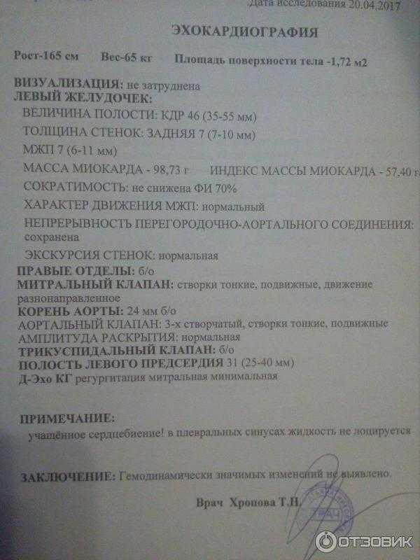 Эхо кг сердца: что это такое, как проводится эхокардиография, какие заболевания можно выявить? | услуги клиники «проксима» (г. сочи)