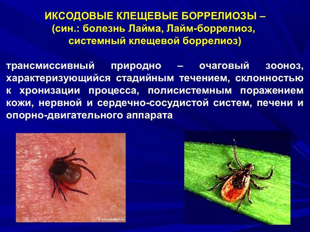 Клинические рекомендации (протокол лечения) оказания медицинской помощи детям больным болезнью лайма