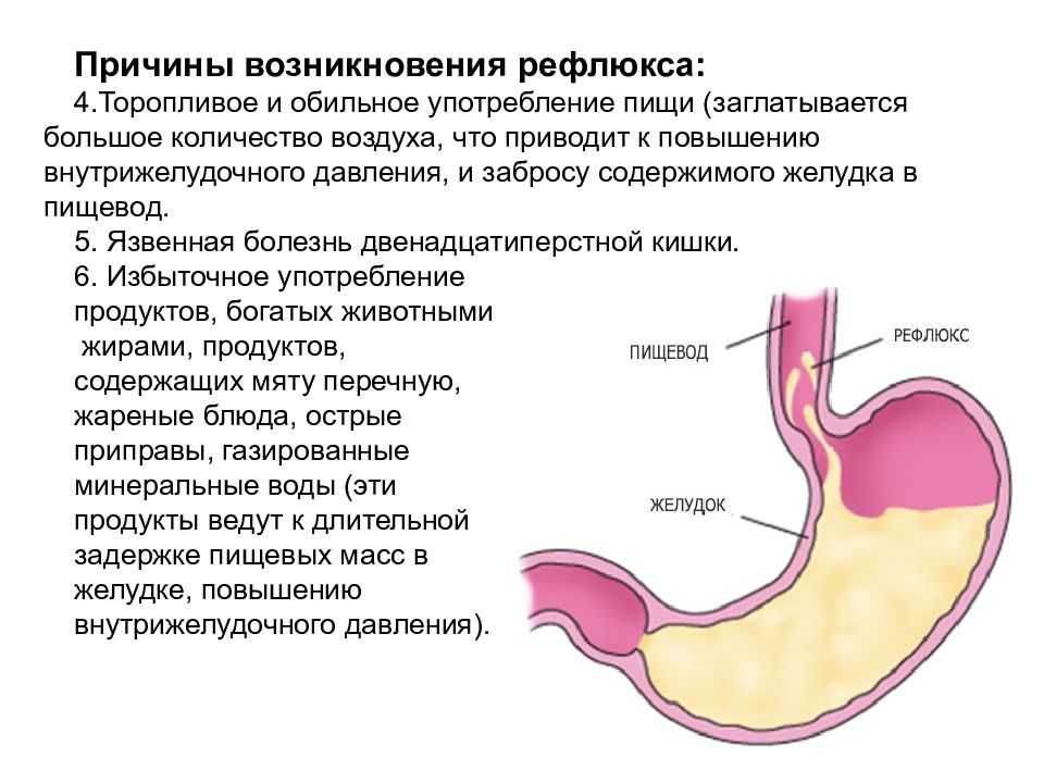 Чем опасен гастродуоденит?