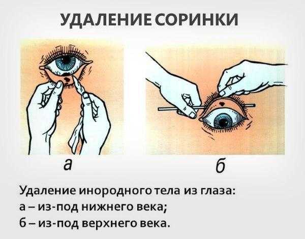 Первая помощь при травмах глаз и век