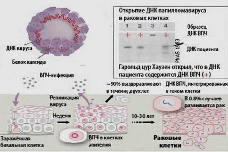 Расшифровка анализа на впч: интерпретация результатов анализов. вероятный диагноз