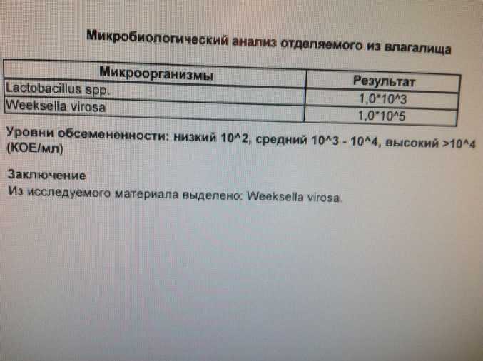 Анализы при планировании беременности