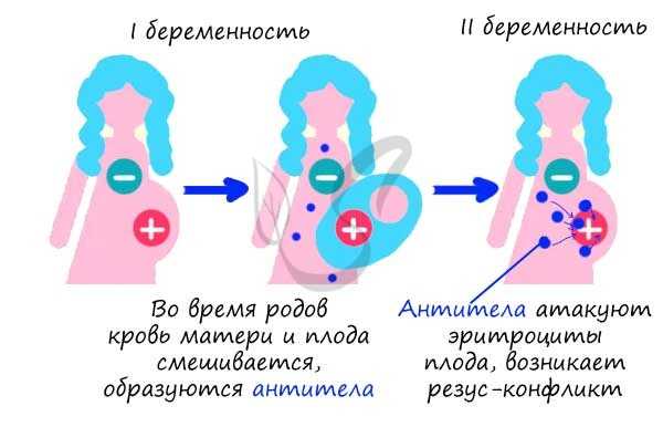 Беременность и резус