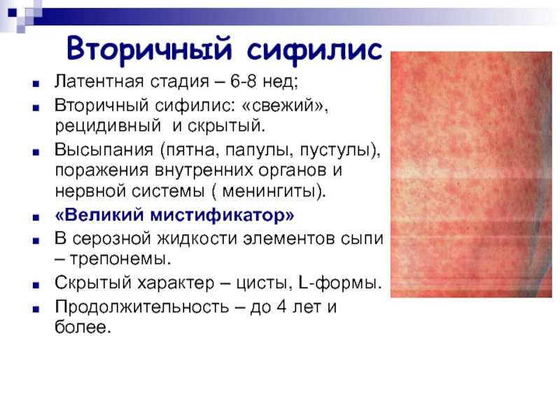 Методы серологической диагностики сифилиса