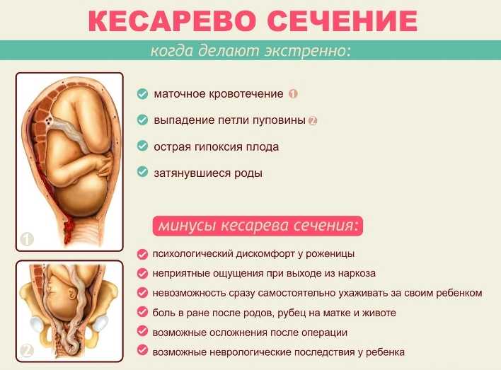 Осложнения во время беременности: как снизить риски наполовину