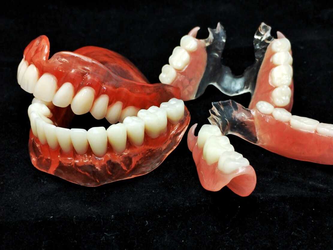Лучшие зубные протезы
