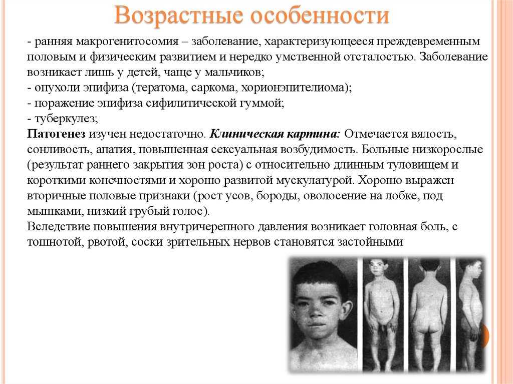 5 этапов полового созревания у мальчиков ( полное описание)