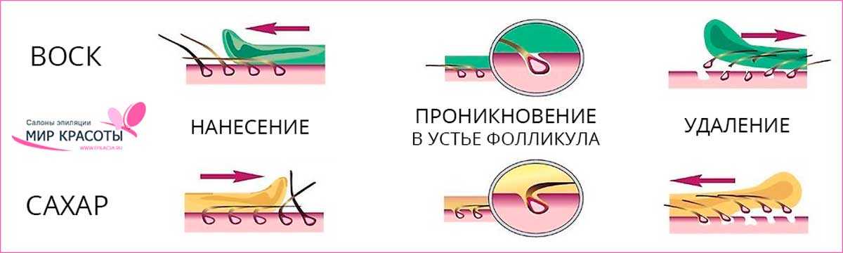 Депиляция воском в домашних условиях