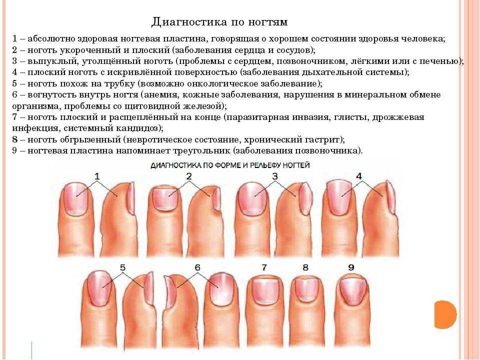 Как восстановить ногти после носки гель-лака? –