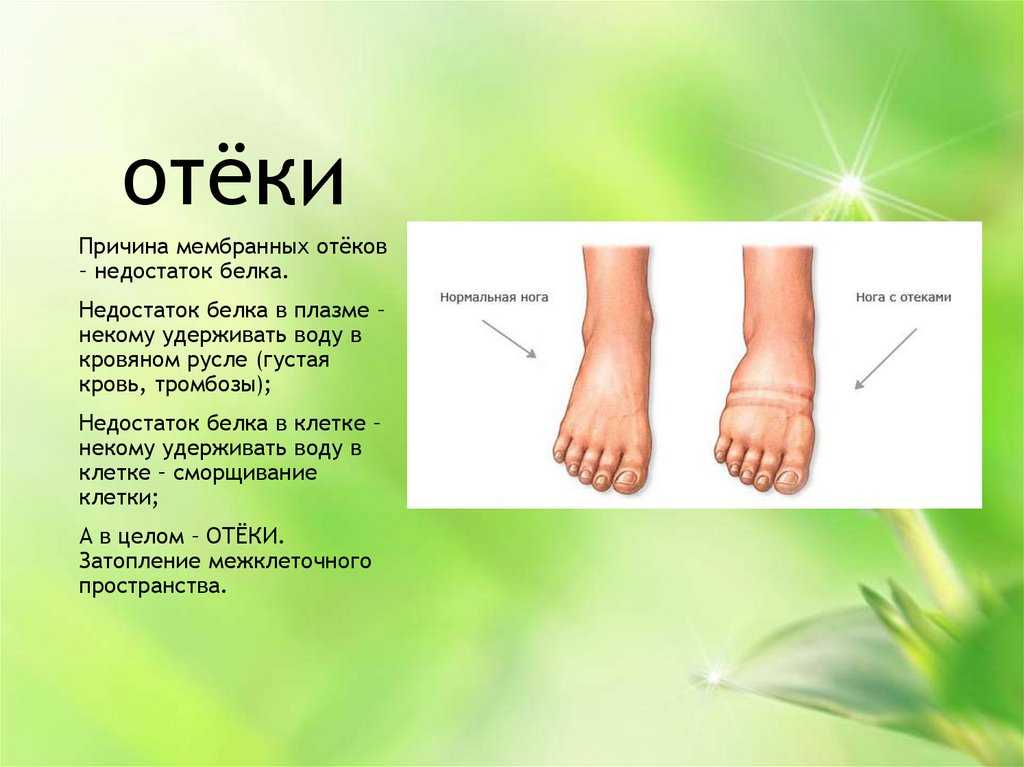 Как выглядят опухшие мешки под глазами: от чего появляется постоянный отек у женщин, почему отекают веки, из-за каких причин опухает лицо, образуются одутловатости и что это означает