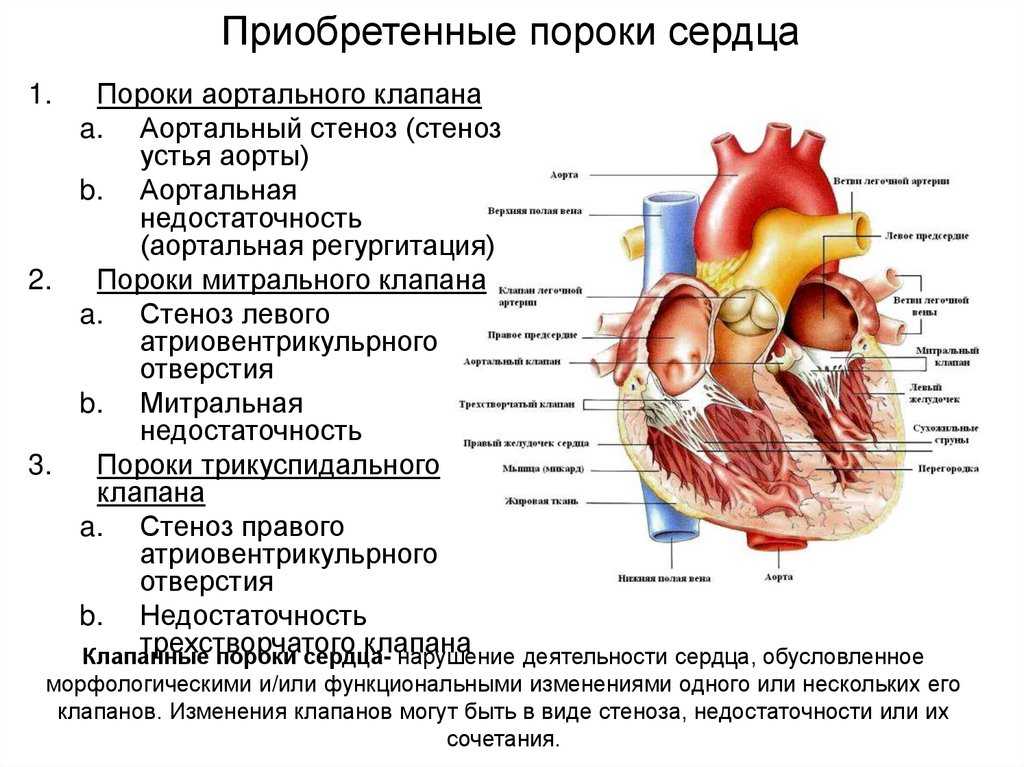 ᐈ чем опасен порок сердца? ~【диагностика и лечение в киеве】