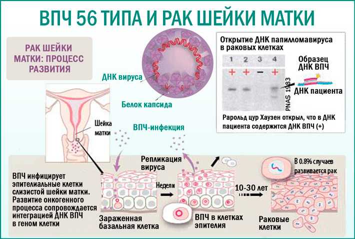 Что делать, если у вас обнаружен вирус папилломы человека (впч)? диагностика, лечение, профилактика.