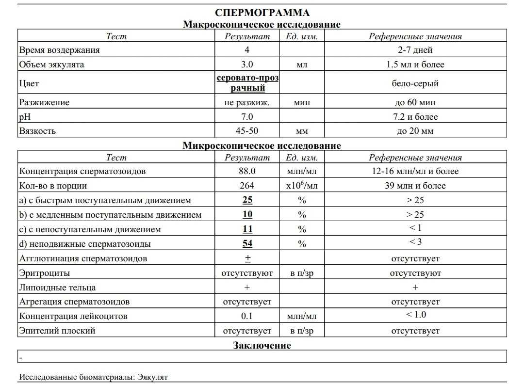 Расшифровка спермограммы