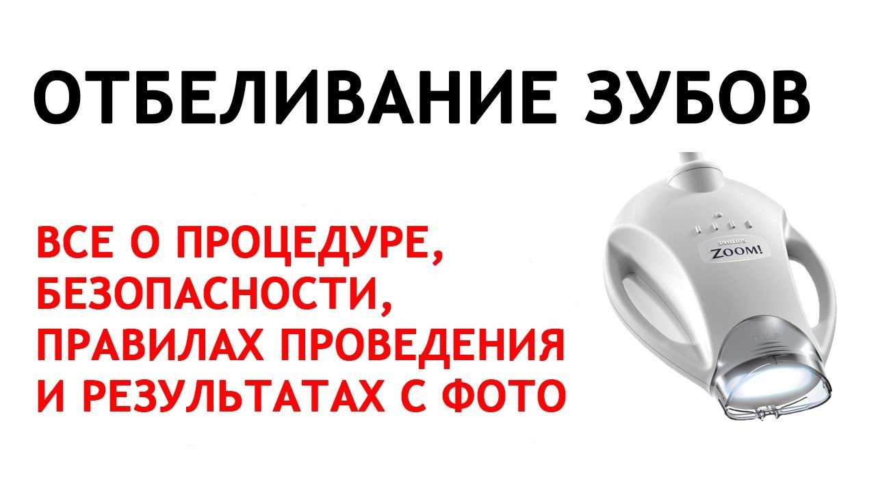 Отбеливание зубов: вред или польза? | журнал startsmile о стоматологии | дзен