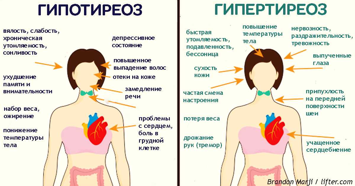 10 признаков нездоровой щитовидной железы - кгбуз горбольница №12
