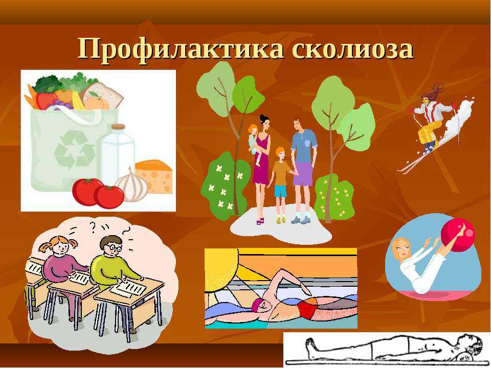 Сколиоз: виды, причины, лечение - kinesiopro