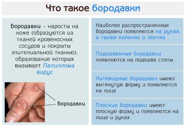 Бородавки на пальцах рук: причины, фото, как избавиться, лечение