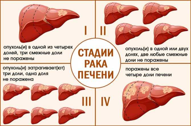 Хронический вирусный гепатит в  (хвгв)