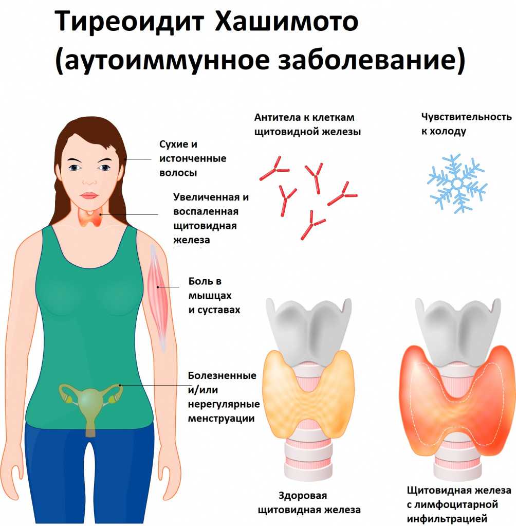 19 причин тазовых болей у женщин