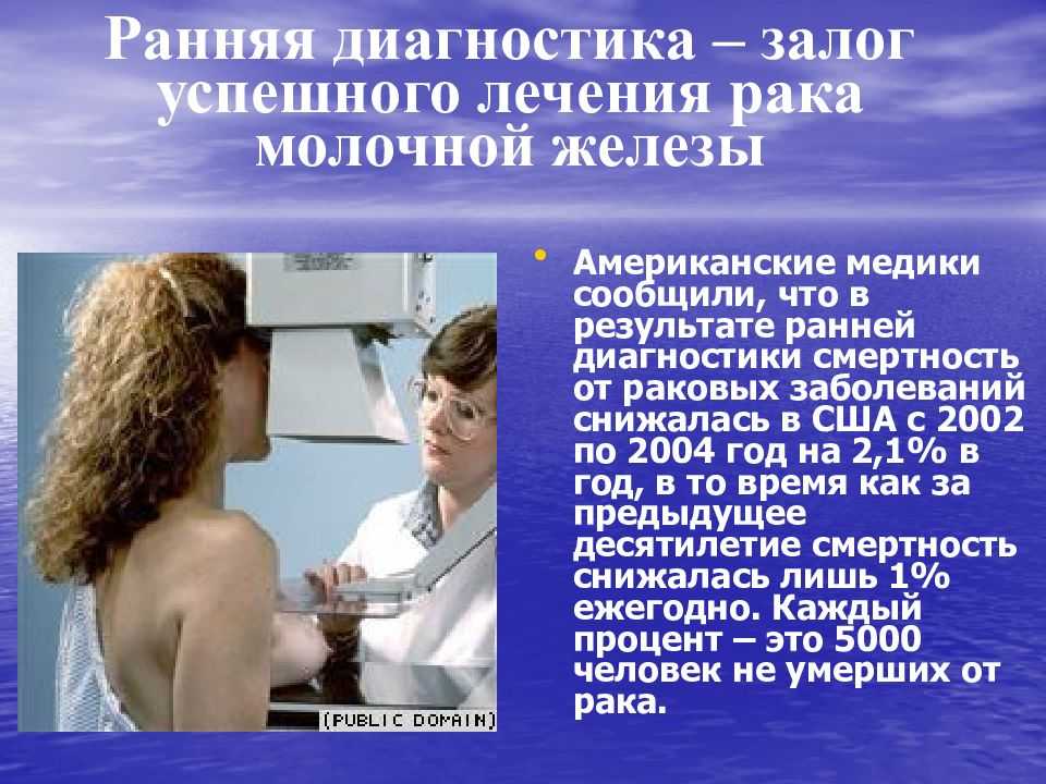 Центр клинической маммологии - часто задаваемые вопросы о раке груди