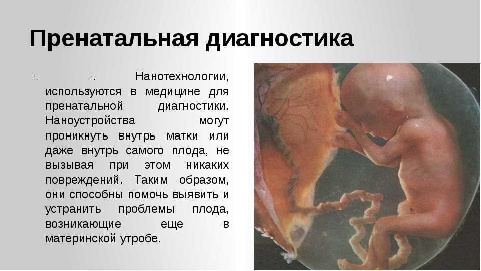 Генетические анализы при планировании беременности