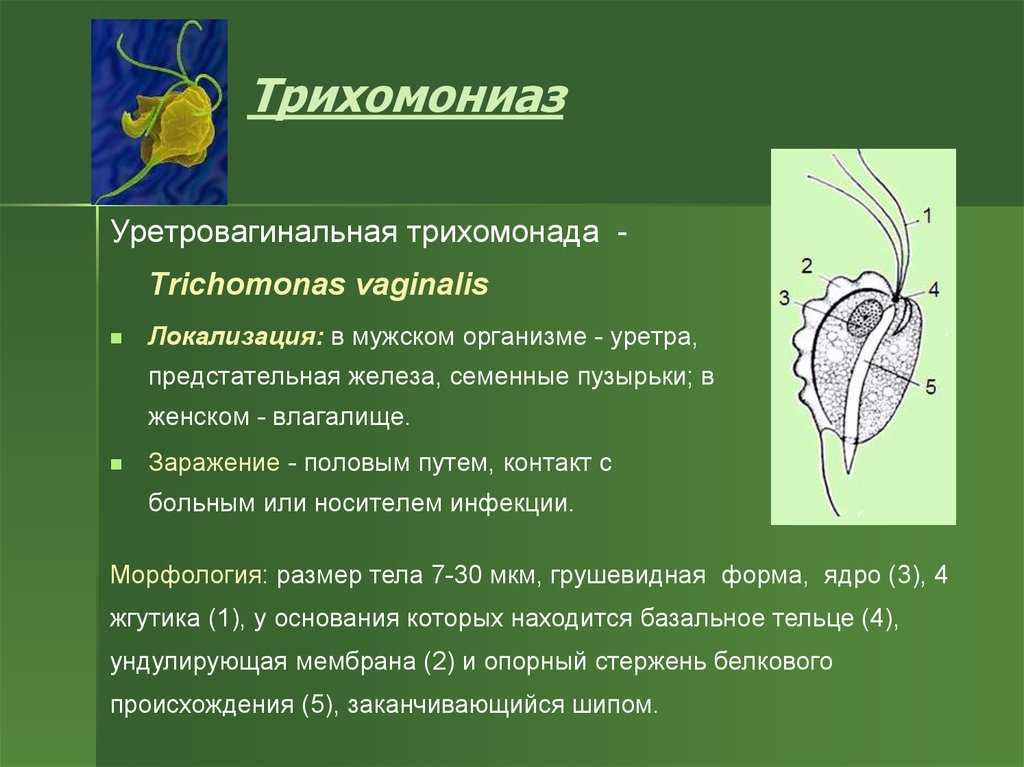 Что делать, если обнаружен трихомониаз?