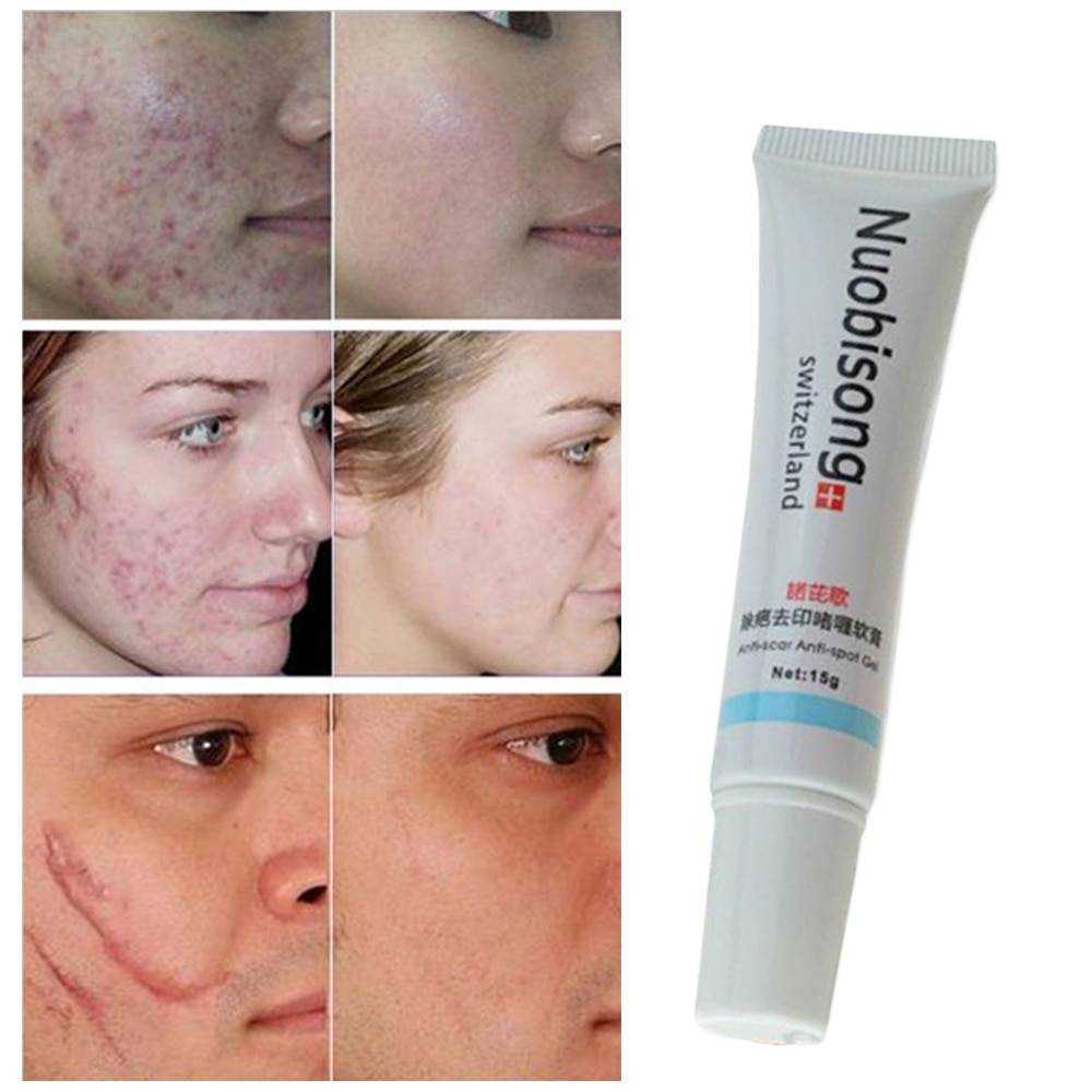 Сода для лица - 32 лучших рецепта - natural-cosmetology.ru