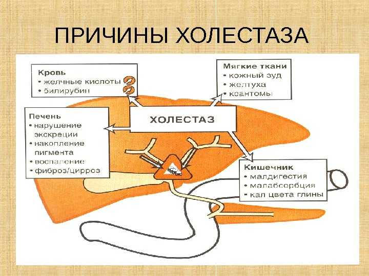 Лейкомаляция у новорожденных: причины, последствия, симптомы, лечение