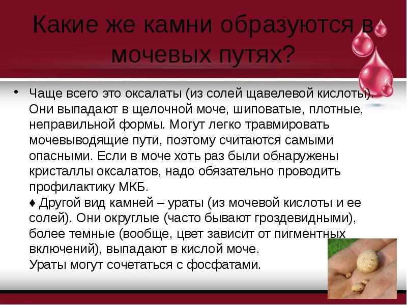Дисметаболическая нефропатия у детей - симптомы болезни, профилактика и лечение дисметаболической нефропатии у детей, причины заболевания и его диагностика на eurolab