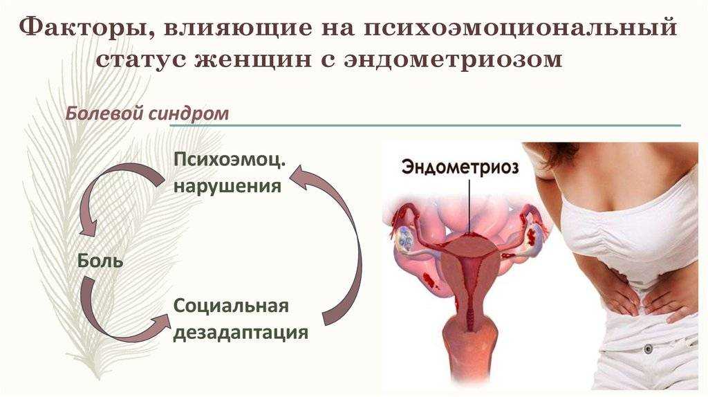 Эндометриоз несет страшные последствия: как выявить и вылечить болезнь