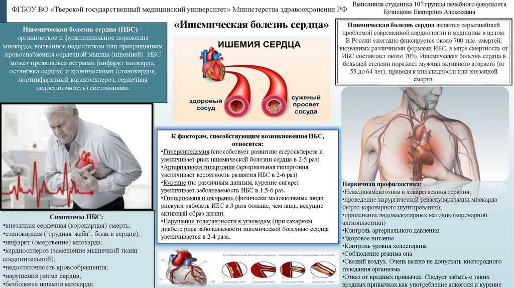 Ишемическая болезнь сердца: симптомы, лечение