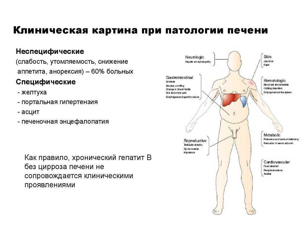 Как понять, что болит печень?