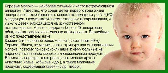Крапивница: причины, симптомы, лечение | энтеросгель