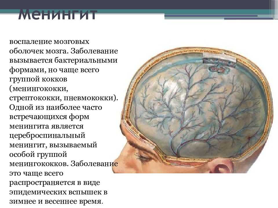 Поражение головного мозга причины. Оболочка головного мозга менингит. Менингит воспаление мозговых оболочек. Менингит мозговые оболочки.
