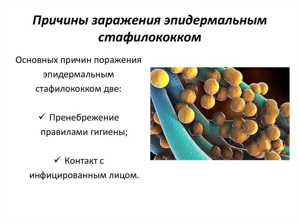 Стафилококк - частая больничная инфекция