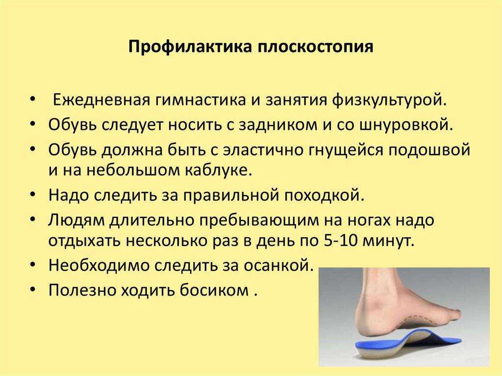 Плоскостопие : симптомы, причины, диагностика и лечение