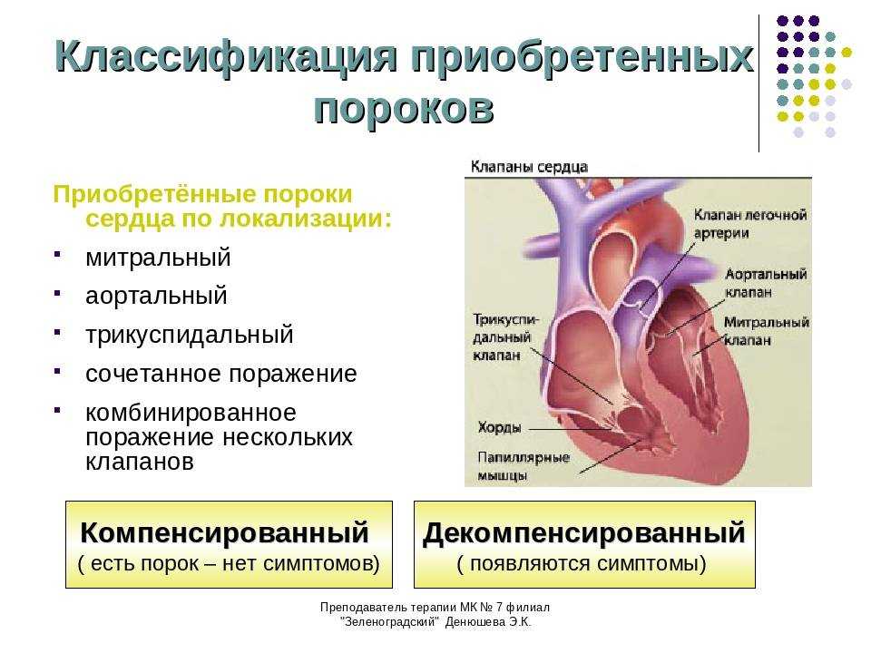 Порок сердца - что это такое, симптомы порока сердца, это смертельно или нет?