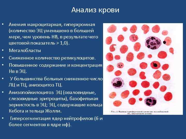 Нейтрофилы в анализе крови: норма и отклонения