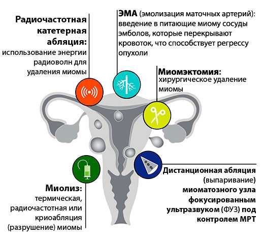 Диагностическая лапаротомия