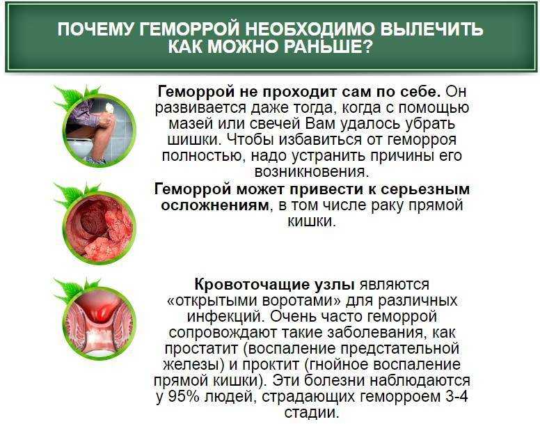 Геморрой признаки симптомы лечение