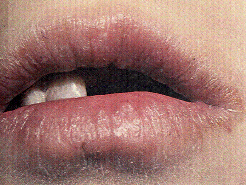 Хейлит (заеда)