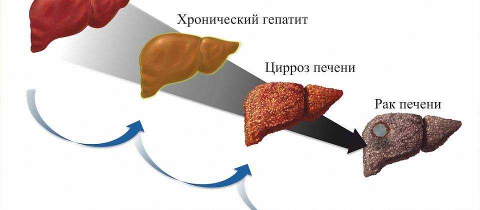 Когда печень сама не справляется