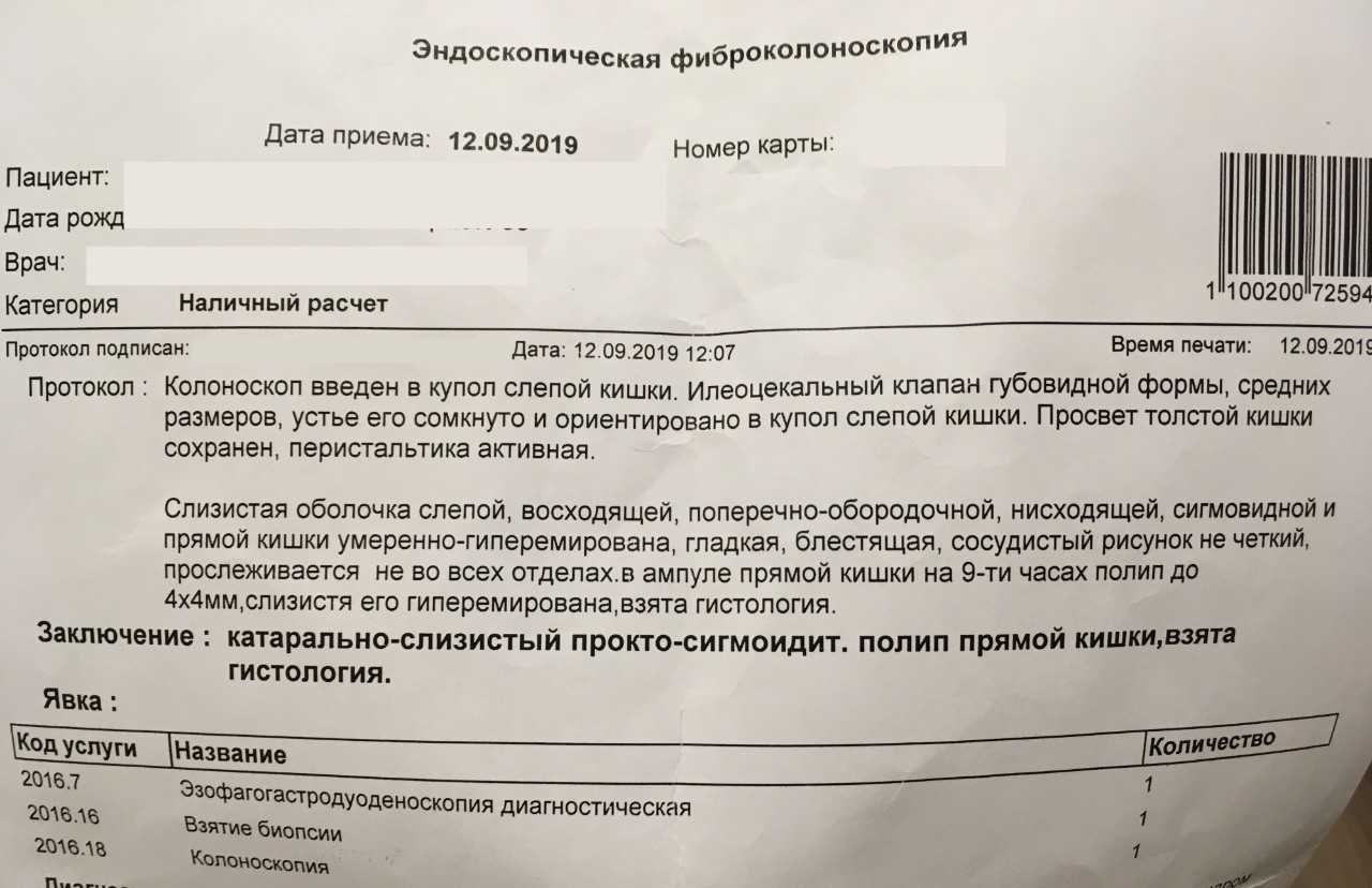 Колоноскопия кишечника: что это за процедура? подготовка к колоноскопии кишечника | клиники «евроонко»