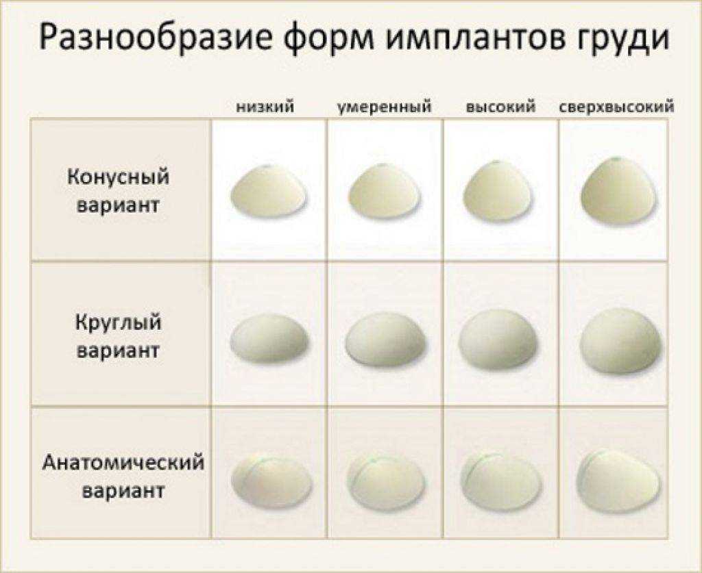 Чем меньше, тем лучше: все, что надо знать об уменьшении груди и его последствиях, рассказала пластический хирург, клиника пасман
