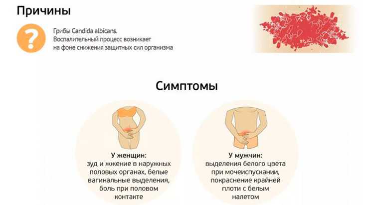 Применение флуконазола для лечения грибковых инфекций в урологии | eurolab | научные статьи
