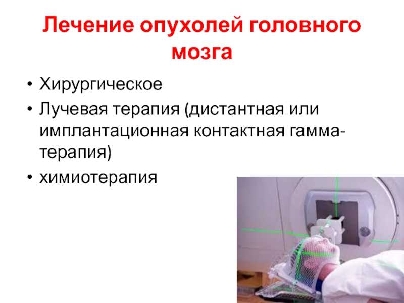 Мозги вылечить. Опухоль головного мозга лечение. Терапия при опухоли головного мозга. Принципы хирургического лечения опухолей головного. Современные методы лечения опухолей головного мозга.