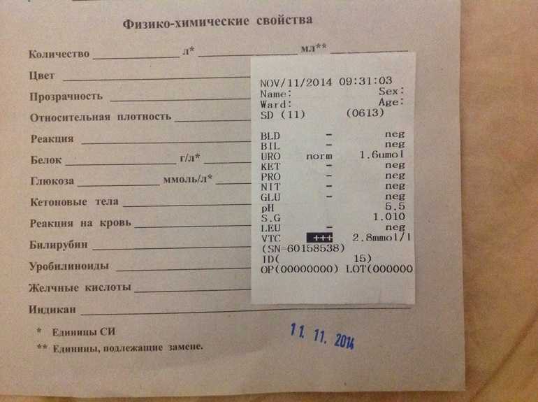 Общий анализ мочи