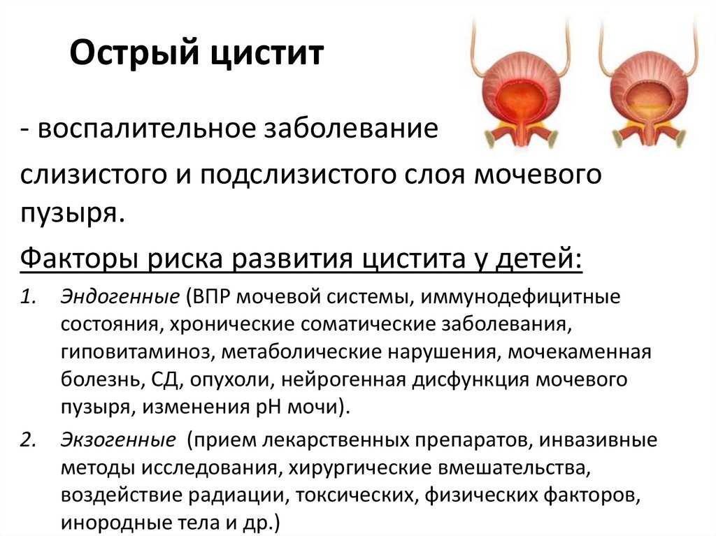 Мужская и женская урология: что лечат урологи