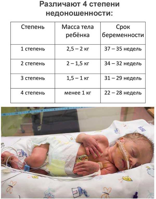Недоношенные