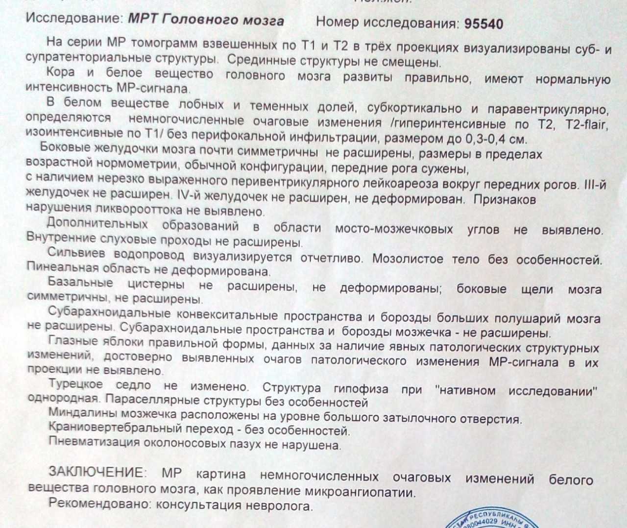 Инфекции головного мозга | неврология | заболевания